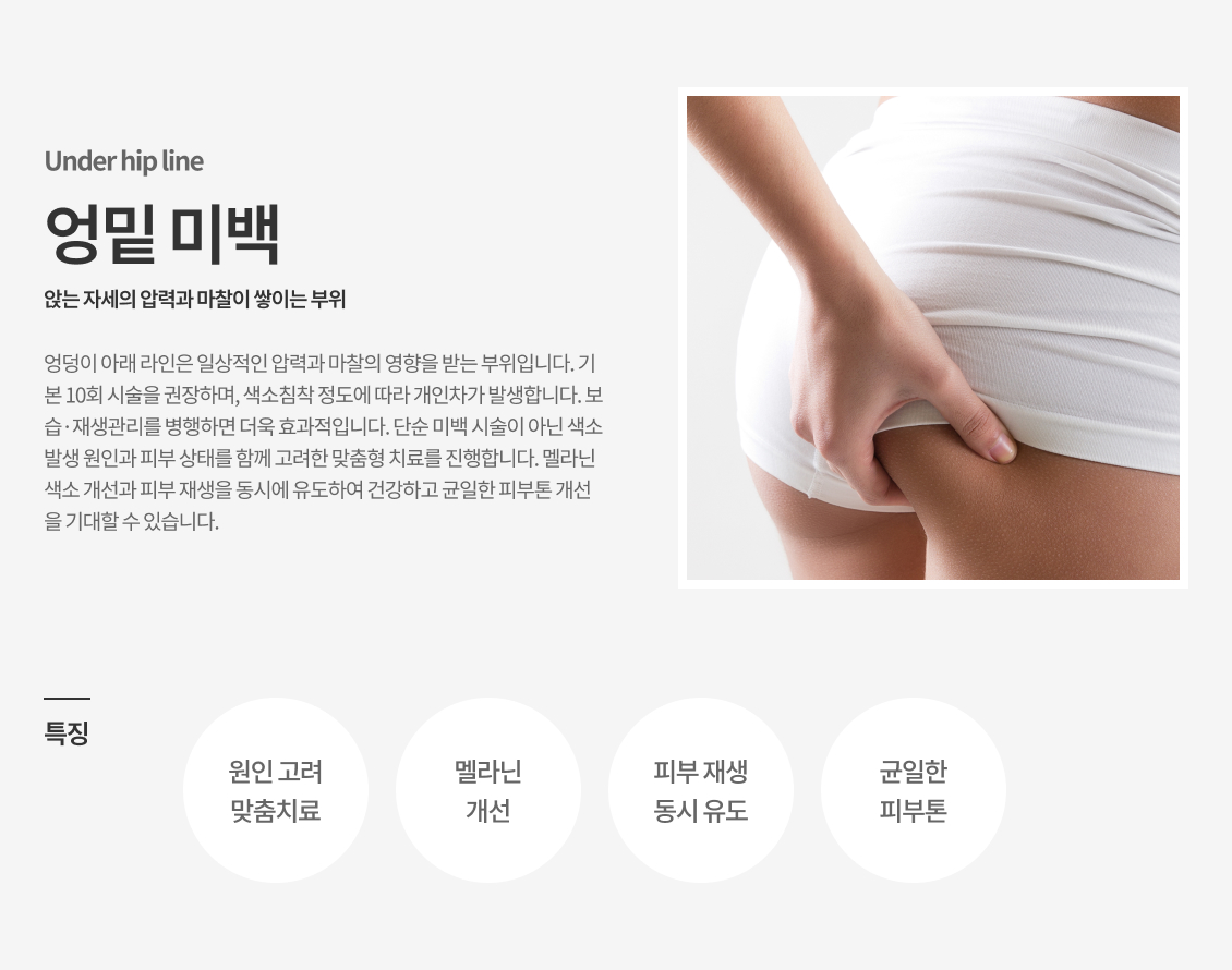 엉밑