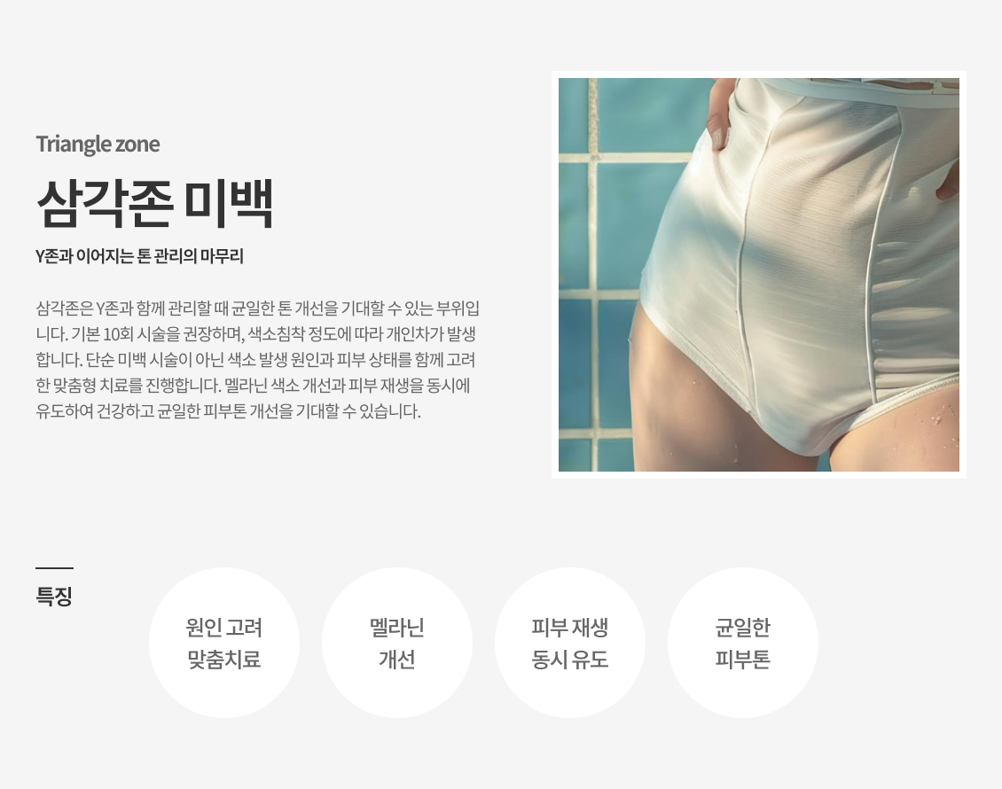 삼각존