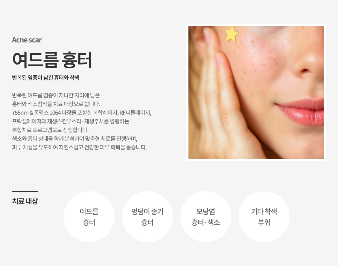 여드름흉터