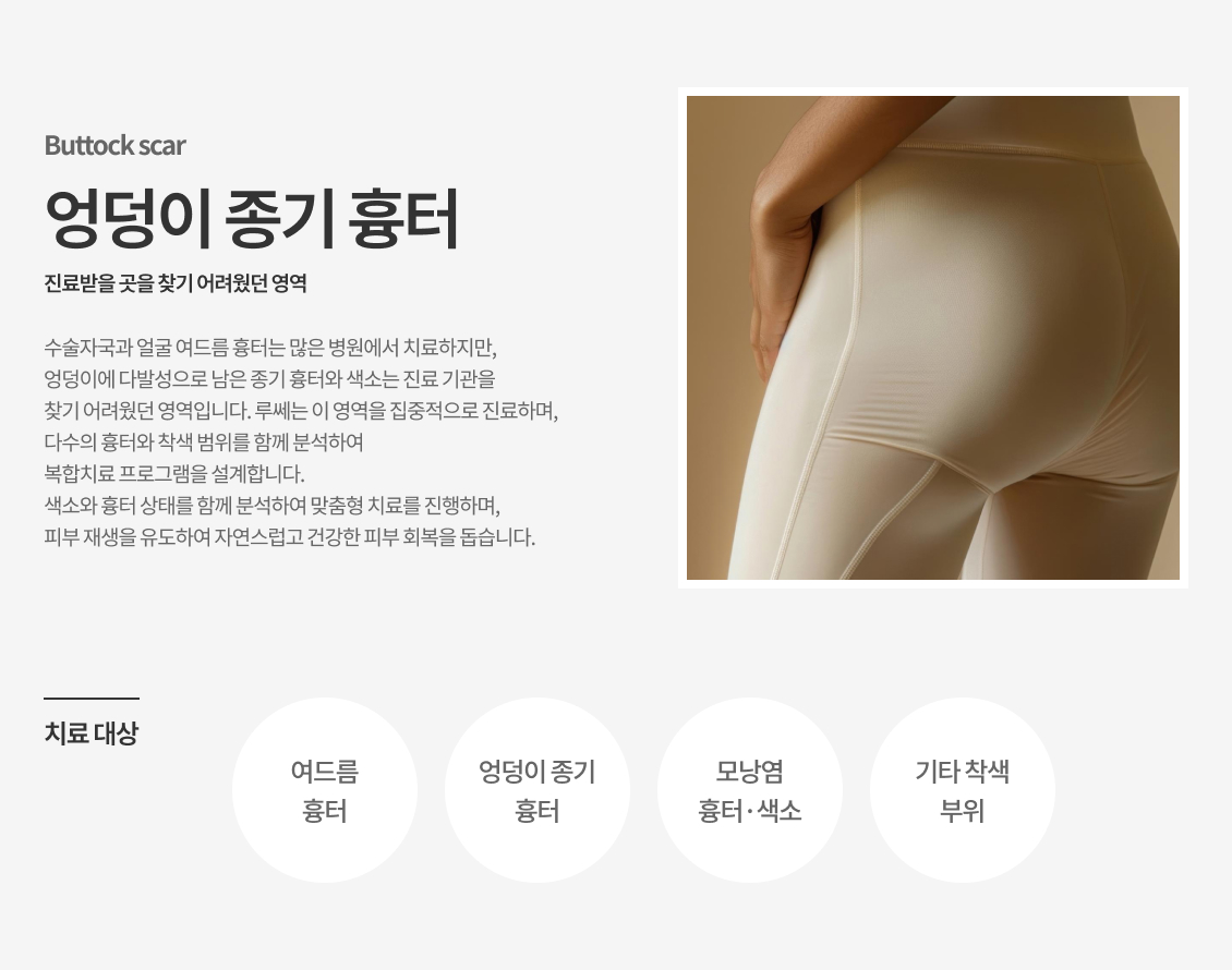 엉덩이 종기 흉터