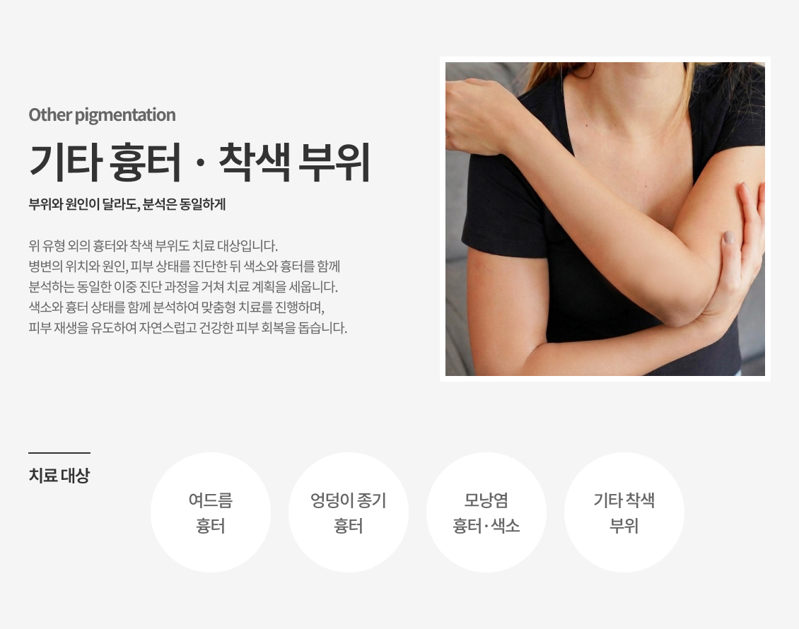 기타 착색 부위